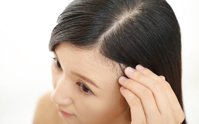 Gội đầu bằng bia trị gàu hiệu quả