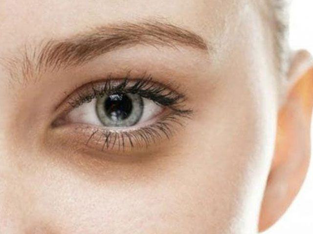 cách làm hết thâm quầng mắt sau 1 đêm
