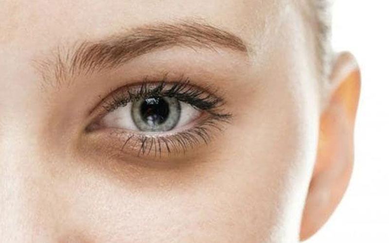 cách làm hết thâm quầng mắt sau 1 đêm
