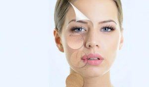 cách trị nám tàn nhang