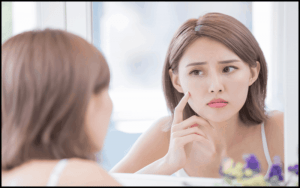 Kem trị nếp nhăn