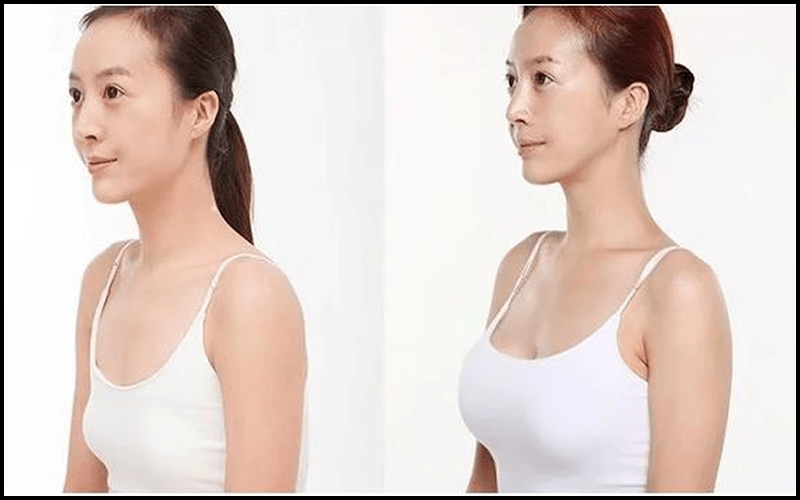 Việc sử dụng thuốc tăng size vòng 1 cần kết hợp với các kỹ thuật massage phù hợp