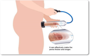Máy tăng kích thước dương vật