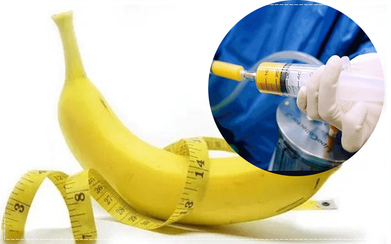 Ai nên cấy mỡ tự thân vào dương vật?