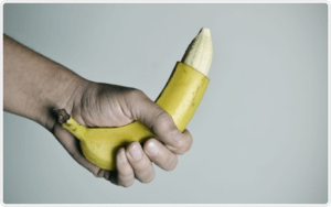 Cắt bao quy đầu có tăng kích thước