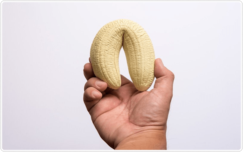 Khi dương vật cương cứng, bị cong thường xảy ra ở nam giới trên 40 tuổi