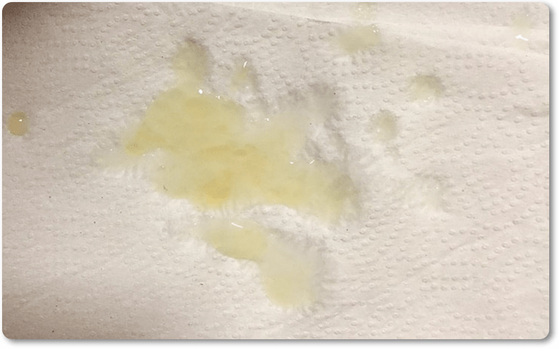 Thông qua màu sắc của tinh trùng, nam giới có thể phán đoán được độ mạnh của tinh trùng