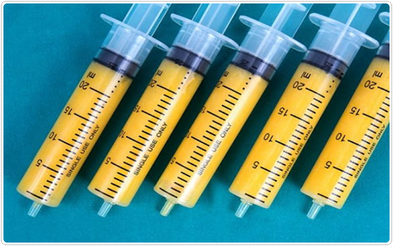 phương pháp nâng ngực không xâm lấn duy nhất không cần phẫu thuật, bạn chỉ cần sử dụng dụng cụ chuyên dụng để loại bỏ mỡ thừa