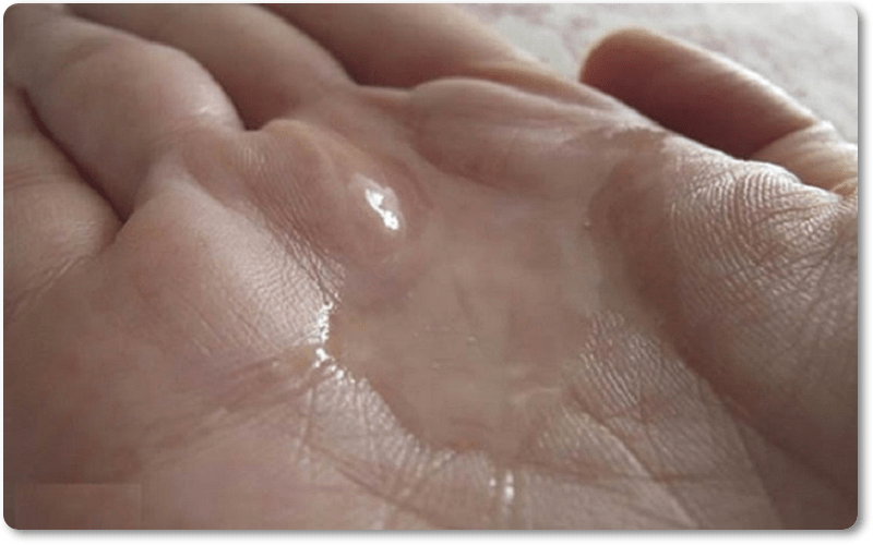 Tinh trùng loãng có phải yếu không?