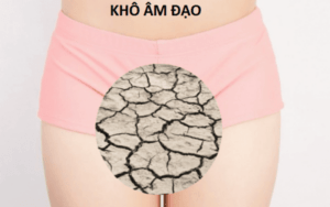 Khô âm đạo là gì?